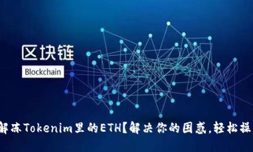 : 如何轻松解冻Tokenim里的ETH？解决你的困惑，轻松操作一步到位！